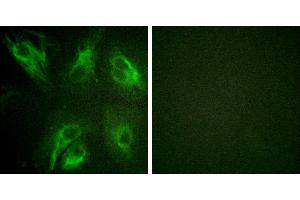 P-peptide - +Immunofluorescence analysis of HeLa cells, using Calsenilin/KCNIP3 (Phospho-Ser63) antibody.