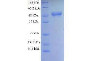 SDS-PAGE (SDS) image for Histone Deacetylase 4 (HDAC4) (AA 1-227), (partial) protein (GST tag) (ABIN5713106)