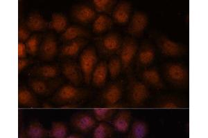 Immunofluorescence analysis of HeLa cells using IPO8 Polyclonal Antibody at dilution of 1:100. (Importin 8 Antikörper)