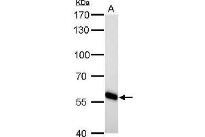 Western Blotting (WB) image for anti-Cytochrome P450, Family 27, Subfamily A, Polypeptide 1 (CYP27A1) (Center) antibody (ABIN2855688)