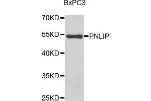 Western blot analysis of extracts of BxPC-3 cells, using PNLIP antibody (ABIN5975718) at 1/1000 dilution.