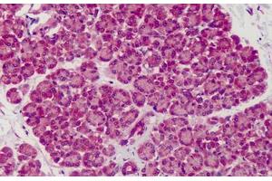 Human Pancreas: Formalin-Fixed, Paraffin-Embedded (FFPE) (SLIT1 Antikörper  (AA 487-504))