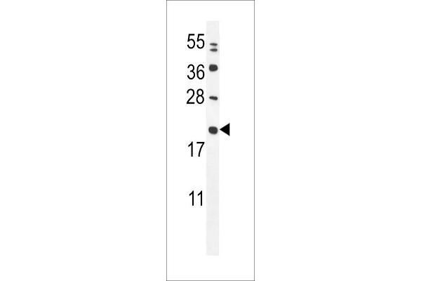 CHCHD4 Antikörper  (C-Term)