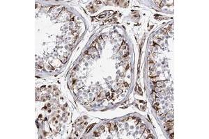 Immunohistochemical staining of human testis with ALG1L polyclonal antibody  shows strong cytoplasmic positivity in Sertoli and Leydig cells at 1:50-1:200 dilution. (ALG1L Antikörper)