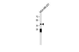 Mu Opioid Receptor 1 Antikörper  (AA 161-187)