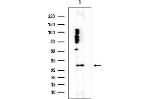 anti-Ribosomal Protein L8 (RPL8) antibody