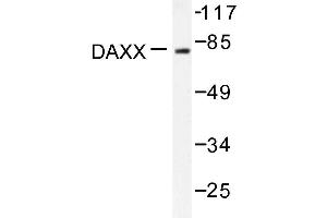 Image no. 1 for anti-Death-Domain Associated Protein (DAXX) antibody (ABIN271883) (DAXX Antikörper)