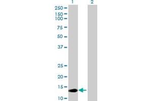 Western Blot analysis of MED22 expression in transfected 293T cell line by MED22 MaxPab polyclonal antibody. (MED22 Antikörper  (AA 1-140))
