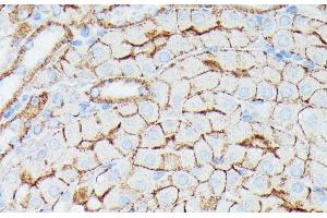 Immunohistochemistry of paraffin-embedded Mouse kidney using IFITM1 Polyclonal Antibody at dilution of 1:100 (40x lens). (IFITM1 Antikörper)