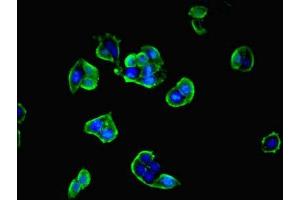 Immunofluorescent analysis of PC-3 cells cells using ABIN7168673 at dilution of 1:100 and Alexa Fluor 488-congugated AffiniPure Goat Anti-Rabbit IgG(H+L) (SECTM1 Antikörper  (AA 29-145))