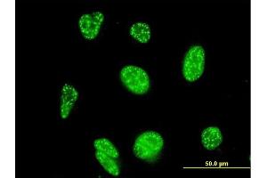 Immunofluorescence of monoclonal antibody to NFATC3 on HeLa cell. (NFATC3 Antikörper  (AA 70-149))