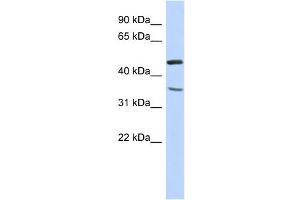WB Suggested Anti-FAM81B Antibody Titration: 0. (FAM81B Antikörper  (N-Term))