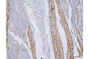 IHC analysis of CD35 using anti-CD35 antibody (ABIN7599703). (CD35 Antikörper  (AA 109-957))