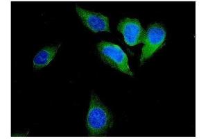 IF analysis of FHIT using anti-FHIT antibody (ABIN3042392).