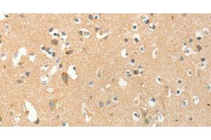 Immunohistochemistry of paraffin-embedded Human brain tissue using AANAT Polyclonal Antibody at dilution 1:40 (AANAT Antikörper)