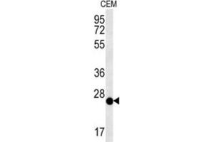Western Blotting (WB) image for anti-Cysteine-Rich Secretory Protein LCCL Domain Containing 2 (CRISPLD2) antibody (ABIN3002383) (CRISPLD2 Antikörper)
