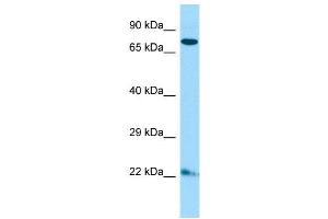Host:  Rabbit  Target Name:  Zfp74  Sample Type:  Mouse Lung lysates  Antibody Dilution:  1. (ZNF74 Antikörper  (C-Term))