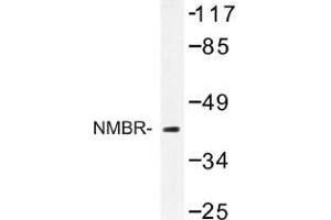 Image no. 1 for anti-Neuromedin B Receptor (NMBR) antibody (ABIN317709) (NMBR Antikörper)