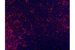 IF analysis of TAPA1/CD81 using anti-TAPA1/CD81 antibody (ABIN5693258). (CD81 Antikörper  (AA 116-201))