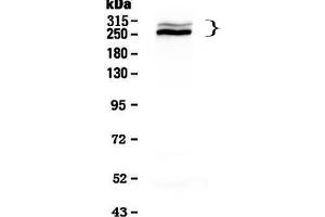 Western blot analysis of Desmoplakin using anti-Desmoplakin antibody . (Desmoplakin Antikörper  (AA 1810-2092))