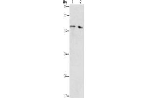 Gel: 10 % SDS-PAGE, Lysate: 40 μg, Lane 1-2: Human liver cancer tissue, Human fetal liver tissue, Primary antibody: ABIN7192673(STEAP4 Antibody) at dilution 1/450, Secondary antibody: Goat anti rabbit IgG at 1/8000 dilution, Exposure time: 40 seconds (STEAP4 Antikörper)