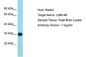 Host: Rabbit Target Name: LSM14B Sample Type: Fetal Brain lysates Antibody Dilution: 1. (LSM14B Antikörper  (N-Term))