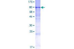 DENND1A Protein (AA 1-559) (GST tag)