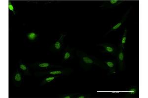 Immunofluorescence of monoclonal antibody to FASTK on HeLa cell. (FASTK Antikörper  (AA 67-154))