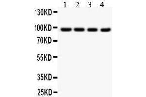 Anti- SLC6A4 Picoband antibody, Western blotting All lanes: Anti SLC6A4  at 0. (SLC6A4 Antikörper  (N-Term))