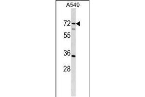 Western Blotting (WB) image for anti-Cytidine and DCMP Deaminase Domain Containing 1 (CDADC1) (AA 483-512), (C-Term) antibody (ABIN5534882)