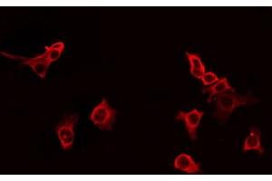 ABIN6266938 staining HT29 by IF/ICC. (GPRIN1 Antikörper  (Internal Region))