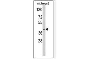 Image no. 3 for anti-Medium-Chain Specific Acyl-CoA Dehydrogenase, Mitochondrial (MCAD) (AA 196-225) antibody (ABIN452704) (Medium-Chain Specific Acyl-CoA Dehydrogenase, Mitochondrial (MCAD) (AA 196-225) Antikörper)
