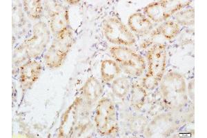 Paraformaldehyde-fixed, paraffin embedded rat kidney, Antigen retrieval by boiling in sodium citrate buffer (pH6) for 15min, Block endogenous peroxidase by 3% hydrogen peroxide for 30 minutes, Blocking buffer (normal goat serum) at 37°C for 20min, Antibody incubation with EPO Polyclonal Antibody, Unconjugated  ) at 1:200 overnight at 4°C, followed by a conjugated secondary and DAB staining. (EPO Antikörper  (AA 101-193))