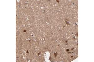 Immunohistochemical staining of human cerebral cortex with STAP2 polyclonal antibody  shows strong cytoplasmic positivity in neuronal cells. (STAP2 Antikörper)