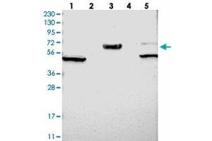 Western blot analysis of Lane 1: RT-4, Lane 2: U-251 MG, Lane 3: Human Plasma, Lane 4: Liver, Lane 5: Tonsil with WSCD2 polyclonal antibody . (WSCD2 Antikörper)