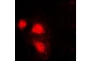 Immunofluorescent analysis of eIF3E staining in Hela cells. (EIF3E Antikörper)
