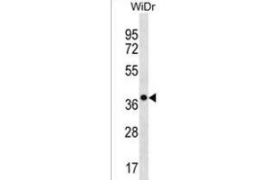 CLCA3P Antibody (Center) (ABIN1538576 and ABIN2850211) western blot analysis in WiDr cell line lysates (35 μg/lane). (CLCA3P Antikörper  (AA 70-98))