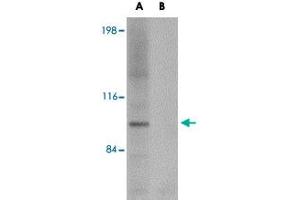 Western blot analysis of NLRP3 in K-562 cell lysate with NLRP3 polyclonal antibody  at 1 ug/mL (A) in the absence and (B) in the presence of blocking peptide. (NLRP3 Antikörper  (AA 120-170))