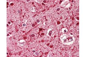 Anti-ASCL3 antibody IHC of human brain, cortex. (ASCL3 Antikörper  (AA 118-130))