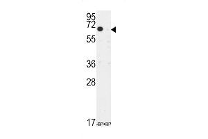 Western blot analysis of anti-TIEG Antibody pre-incubated with and without blocking peptide in CEM cell line lysate. (KLF10/TIEG1 Antikörper  (N-Term))