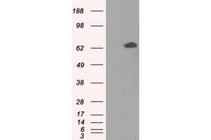 Image no. 2 for anti-Glucose-6-Phosphate Isomerase (GPI) antibody (ABIN1498505) (GPI Antikörper)