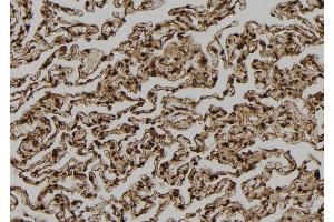 ABIN6272867 at 1/100 staining Human lung tissue by IHC-P. (TPI1 Antikörper  (C-Term))