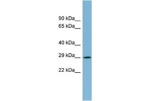 WB Suggested Anti-MPZL2 Antibody Titration:  0. (MPZL2 Antikörper  (N-Term))