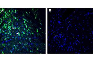 Expression of SEZ6 in mouse substantia nigra pars compacta (SNC).