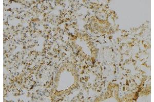 ABIN6277149 at 1/100 staining Human gastric tissue by IHC-P. (HLA-A Antikörper)