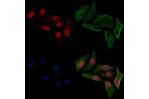 ABIN6254899 and ABIN6267063 staining HepG2 cells(30 min of 4uM Forskolin treatment) by IF/ICC. (Histone H4 Antikörper  (H4K12ac))