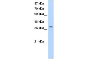 WB Suggested Anti-LAntibody Titration:  1. (LARP7 Antikörper  (C-Term))