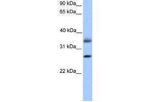 WB Suggested Anti-LGALS8 Antibody Titration: 0. (LGALS8 Antikörper  (C-Term))