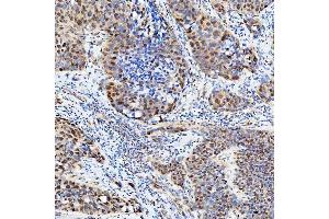 IHC analysis of U1-C/SNRPC using anti-U1-C/SNRPC antibody (ABIN7599016).