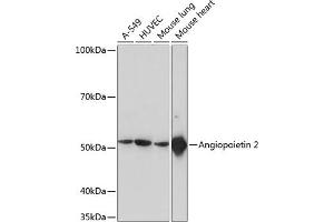 Western blot analysis of extracts of various cell lines, using  Rabbit mAb (ABIN7265589) at 1:1000 dilution.